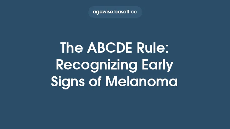 The ABCDE Rule: Recognizing Early Signs of Melanoma Thumbnail
