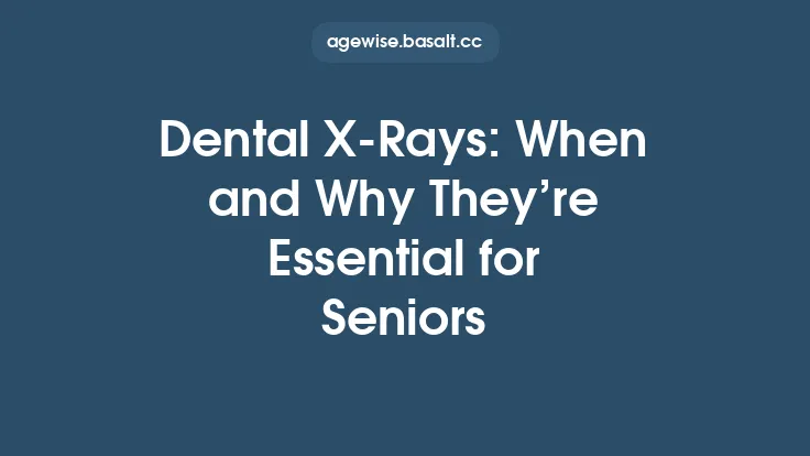 Dental X‑Rays: When and Why They’re Essential for Seniors Thumbnail