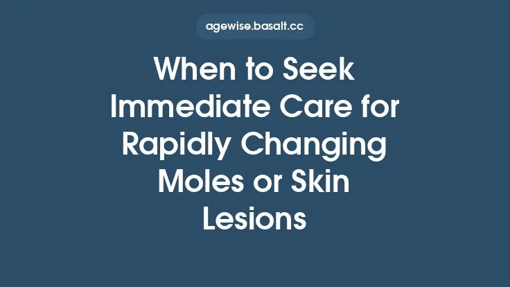 When to Seek Immediate Care for Rapidly Changing Moles or Skin Lesions Thumbnail